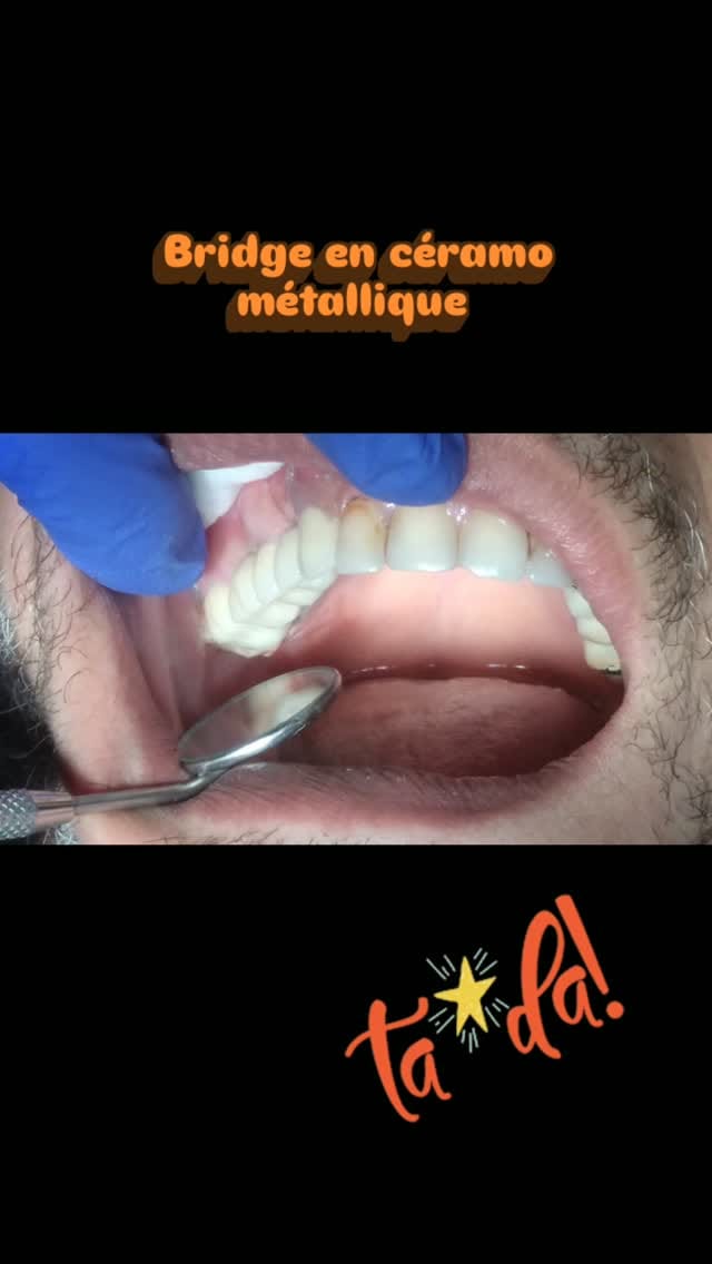 Post 7 by Centre Dentaire Anfa Smile on Instagram (video)
