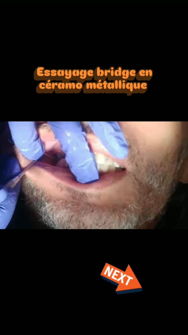 Post 8 by Centre Dentaire Anfa Smile on Instagram (video)