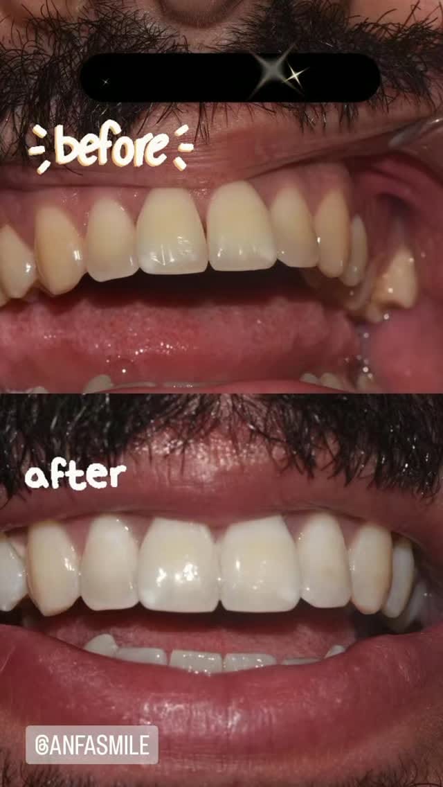 Post 2 by Centre Dentaire Anfa Smile on Instagram (video)