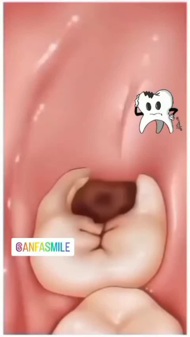 Post 10 by Centre Dentaire Anfa Smile on Instagram (video)