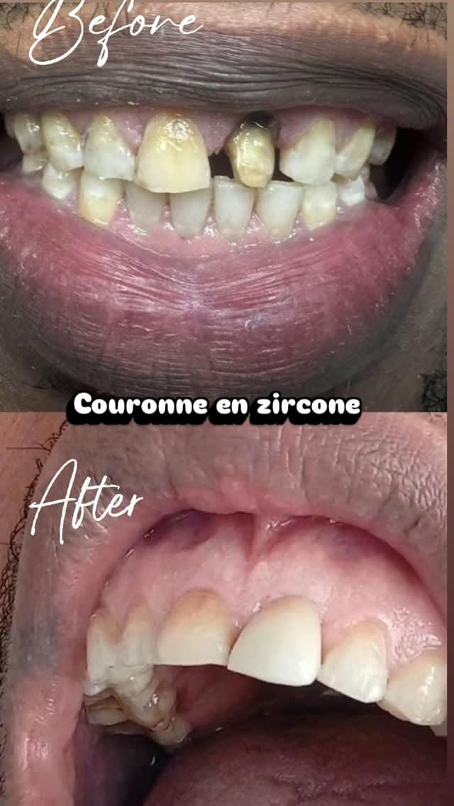 Post 5 by Centre Dentaire Anfa Smile on Instagram (video)