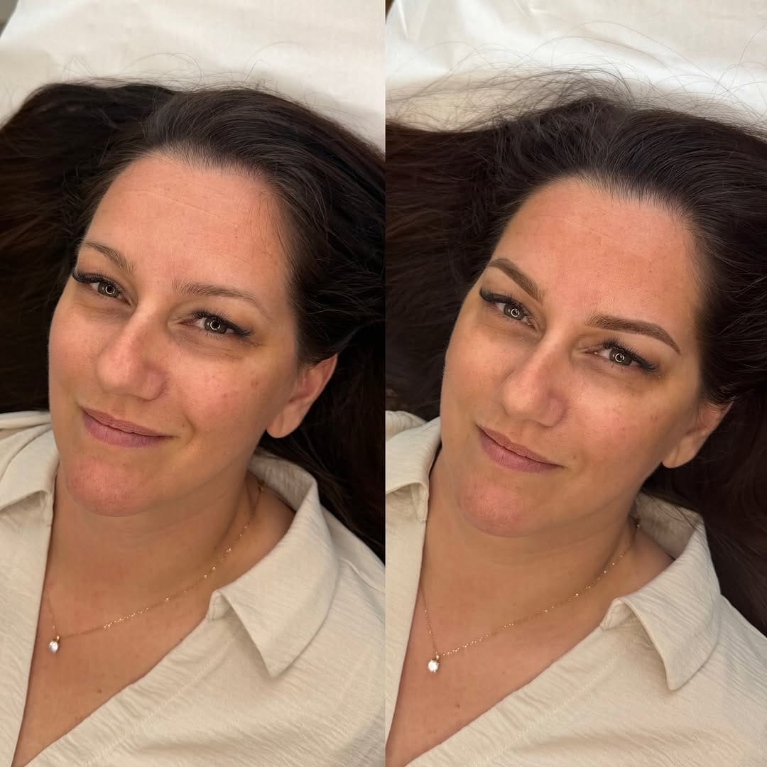 Post 8 by MICROBLADING•SHADING•COMBO•FORMATIONS•FULL LIPS•BROWLIFT on Instagram (carousel)