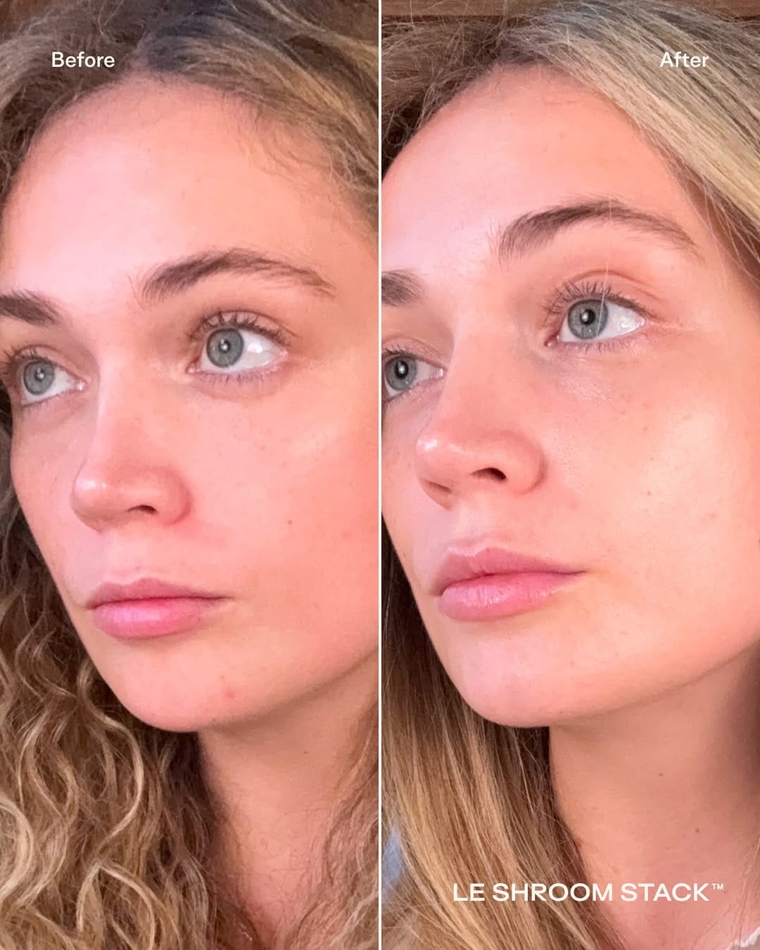 Post 8 by VERDOIE | mushroom skincare on Instagram (image)