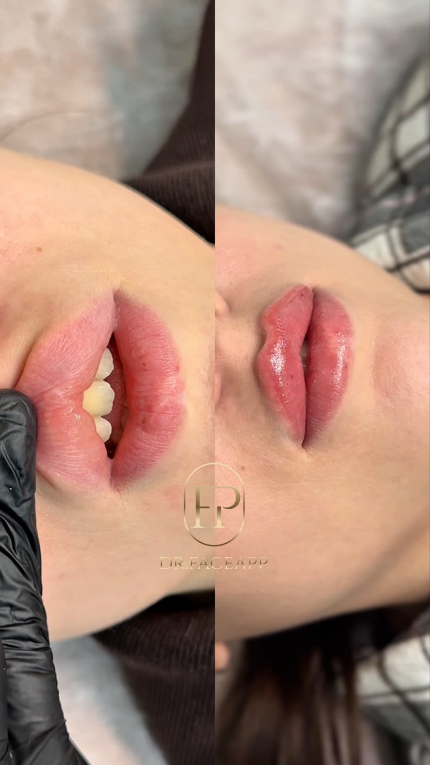 Post 5 by КОСМЕТОЛОГ РОСТОВ ЕРЕВАН COSMETOLOGIST PARIS MARSEILLE NAPLES on Instagram (video)