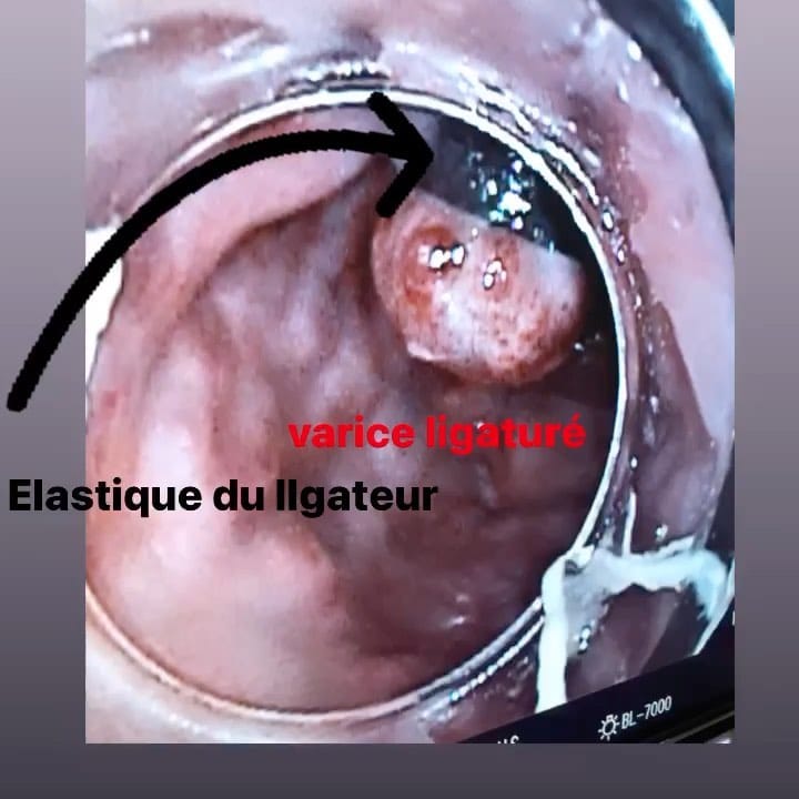 Post 4 by •nurse_lifestyle_fr • on Instagram (video)