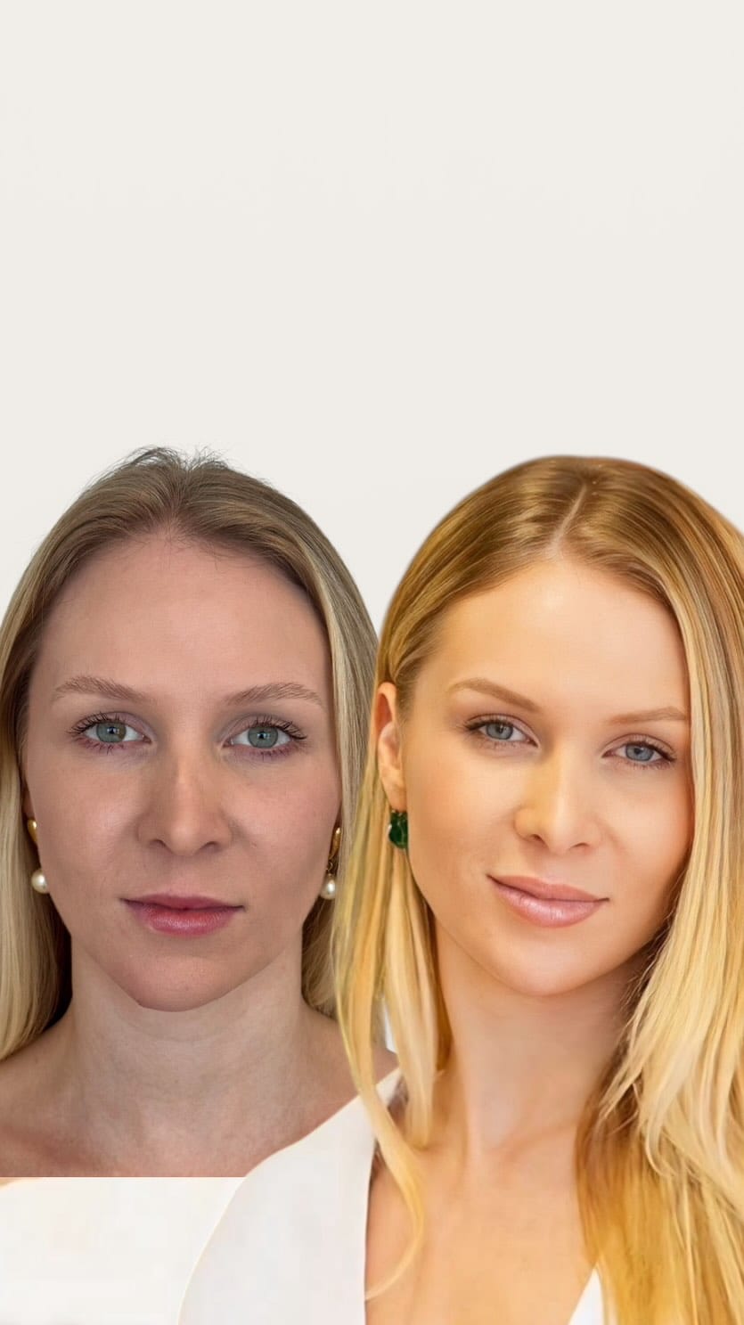 Post 9 by Nicoly Monteiro | Harmonização Facial on Instagram (video)