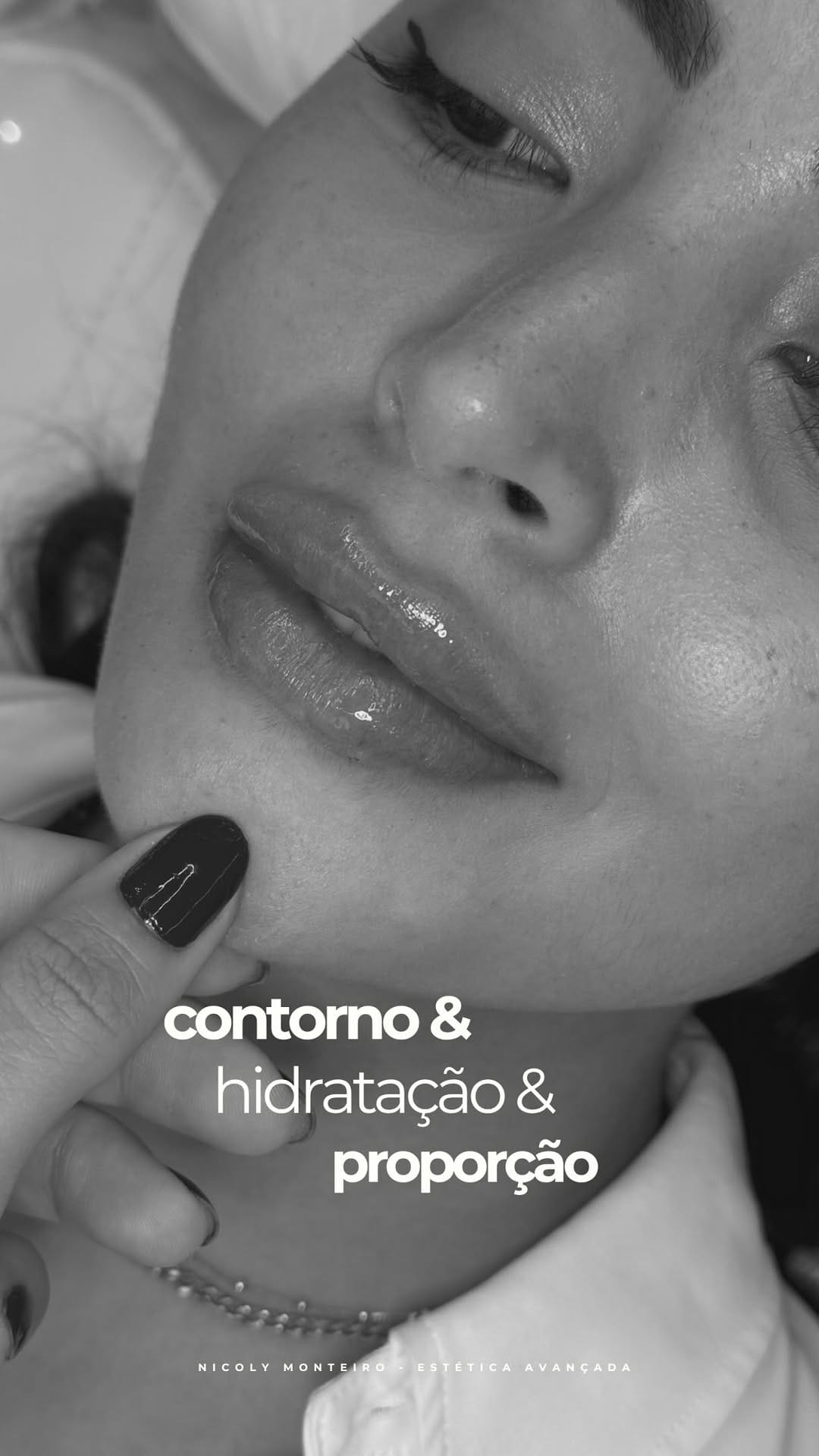 Post 1 by Nicoly Monteiro | Harmonização Facial on Instagram (video)