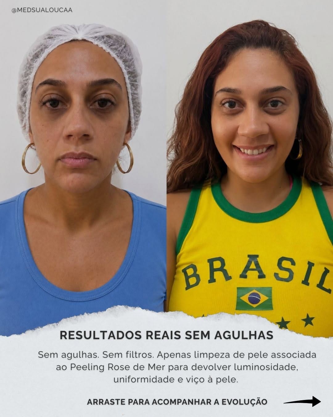 Post 1 by Dr. Jeff • Fisio Estética e Tratamento da Dor on Instagram (carousel)