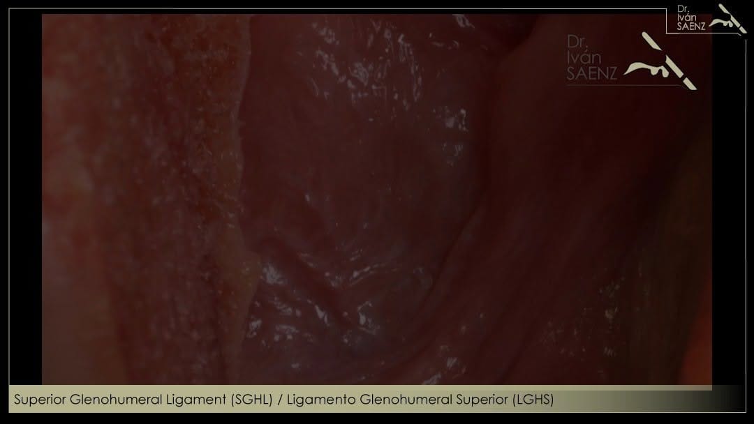 Post 9 by Dr. Iván Sáenz Navarro on Instagram (video)