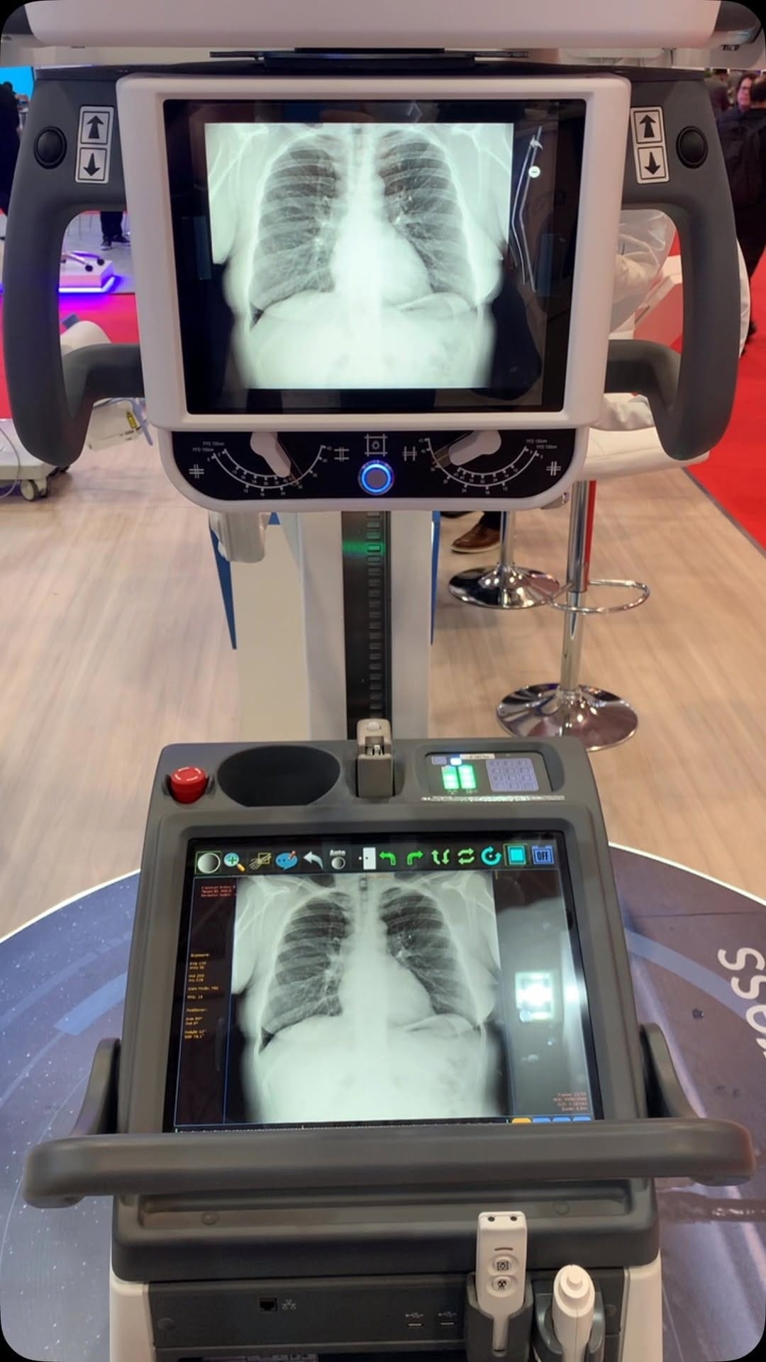Post 10 by Radiologia na Palma da Mão on Instagram (video)