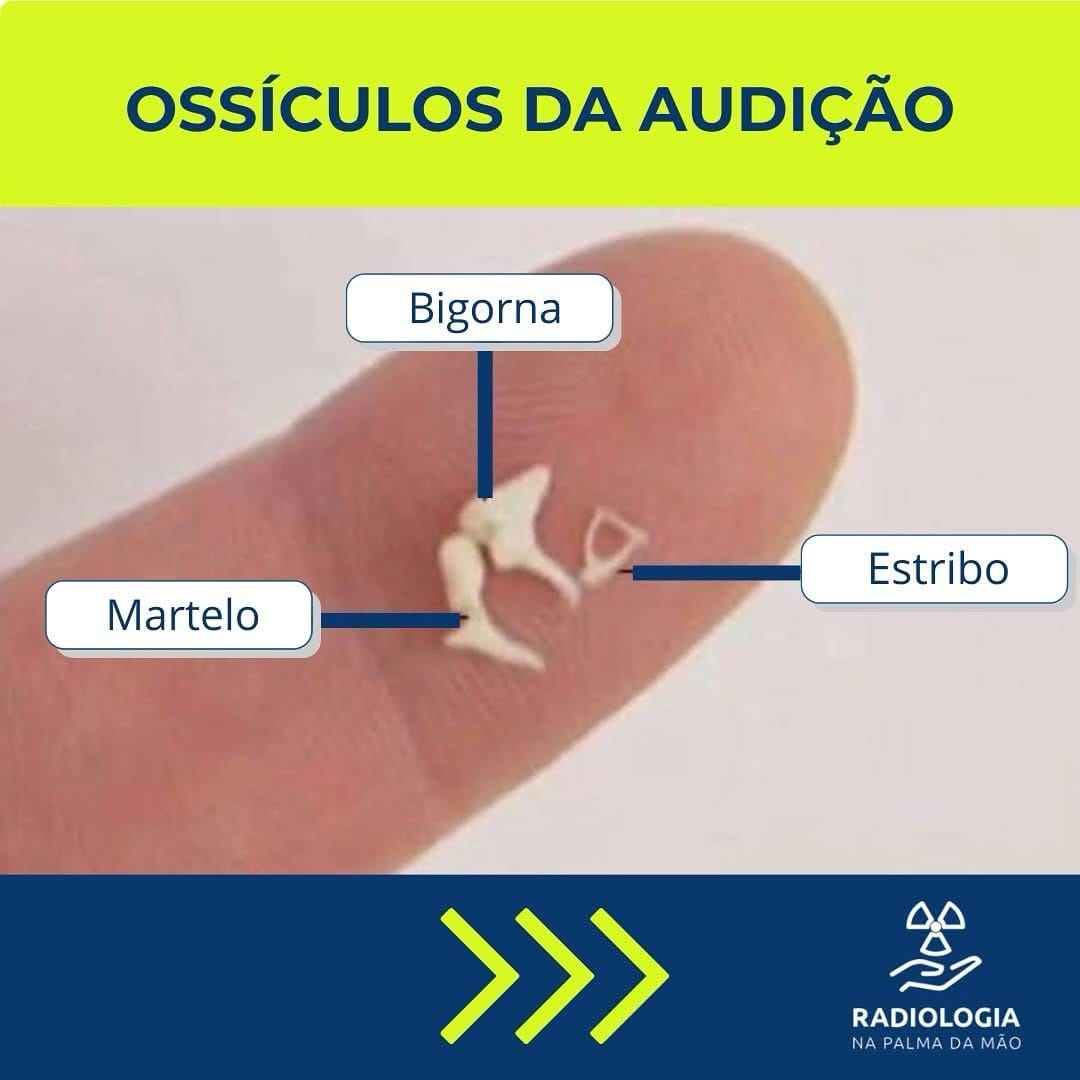 Post 6 by Radiologia na Palma da Mão on Instagram (carousel)
