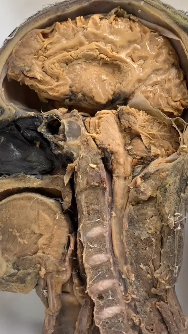 Post 4 by Radiologia na Palma da Mão on Instagram (video)