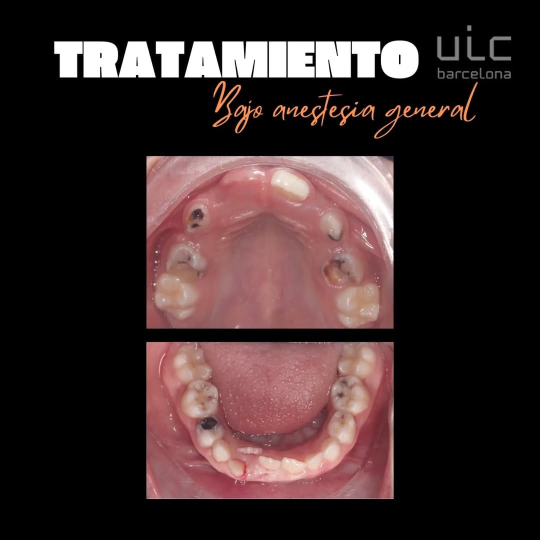 Post 1 by Odontopediatría Uic Barcelona on Instagram (carousel)
