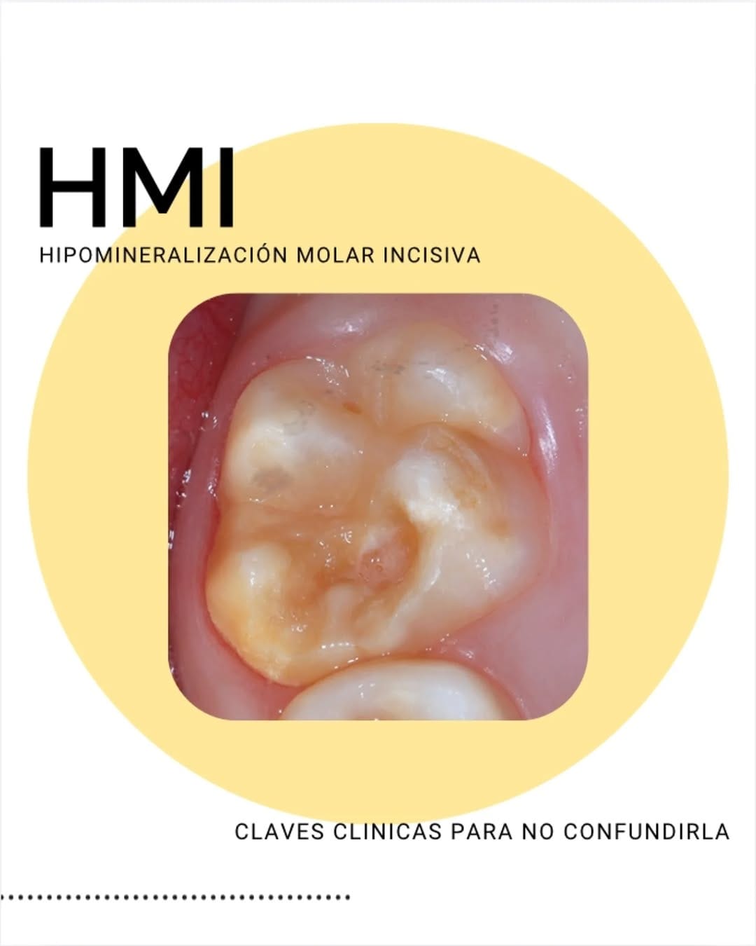 Post 10 by Odontopediatría Uic Barcelona on Instagram (carousel)
