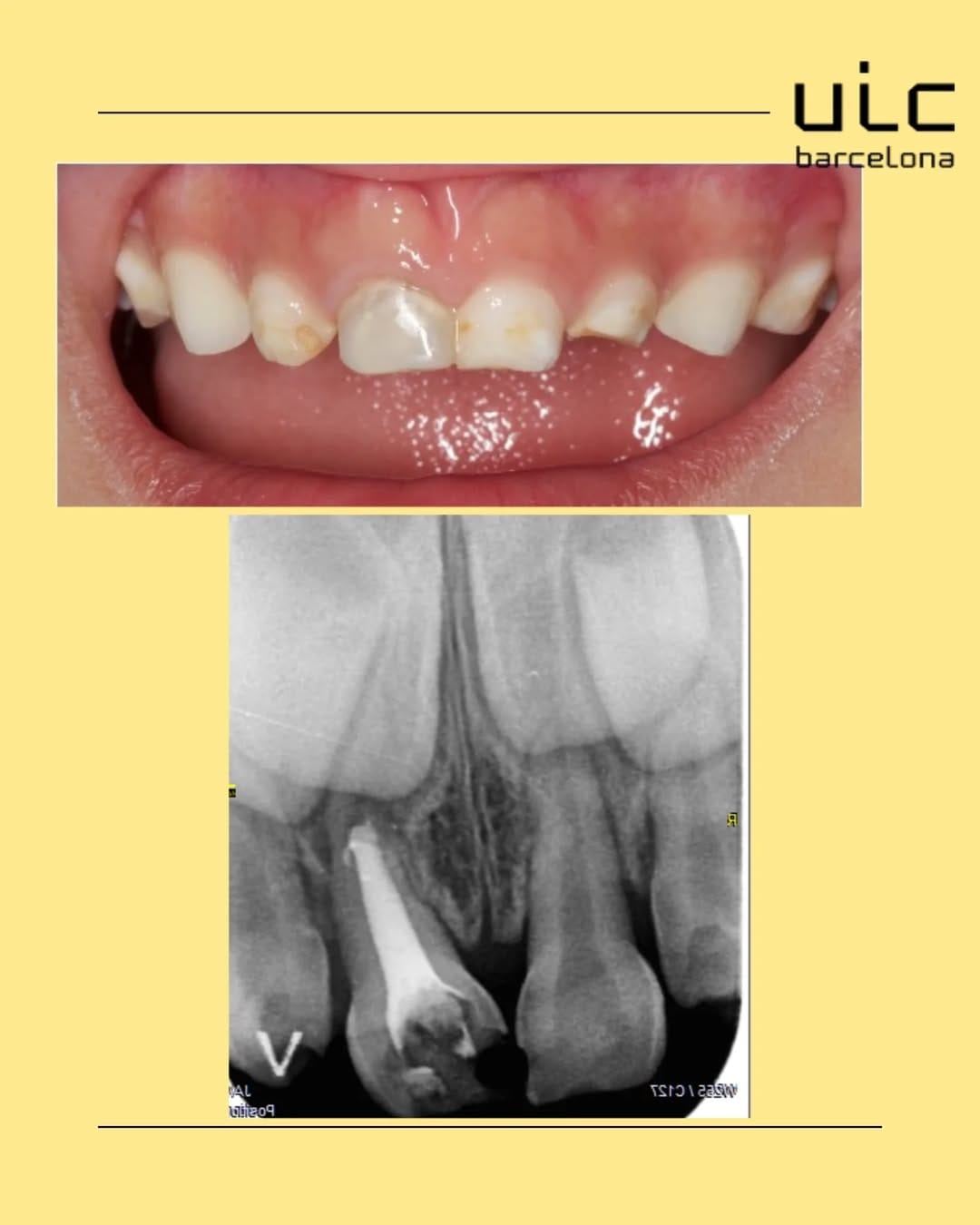 Post 5 by Odontopediatría Uic Barcelona on Instagram (carousel)