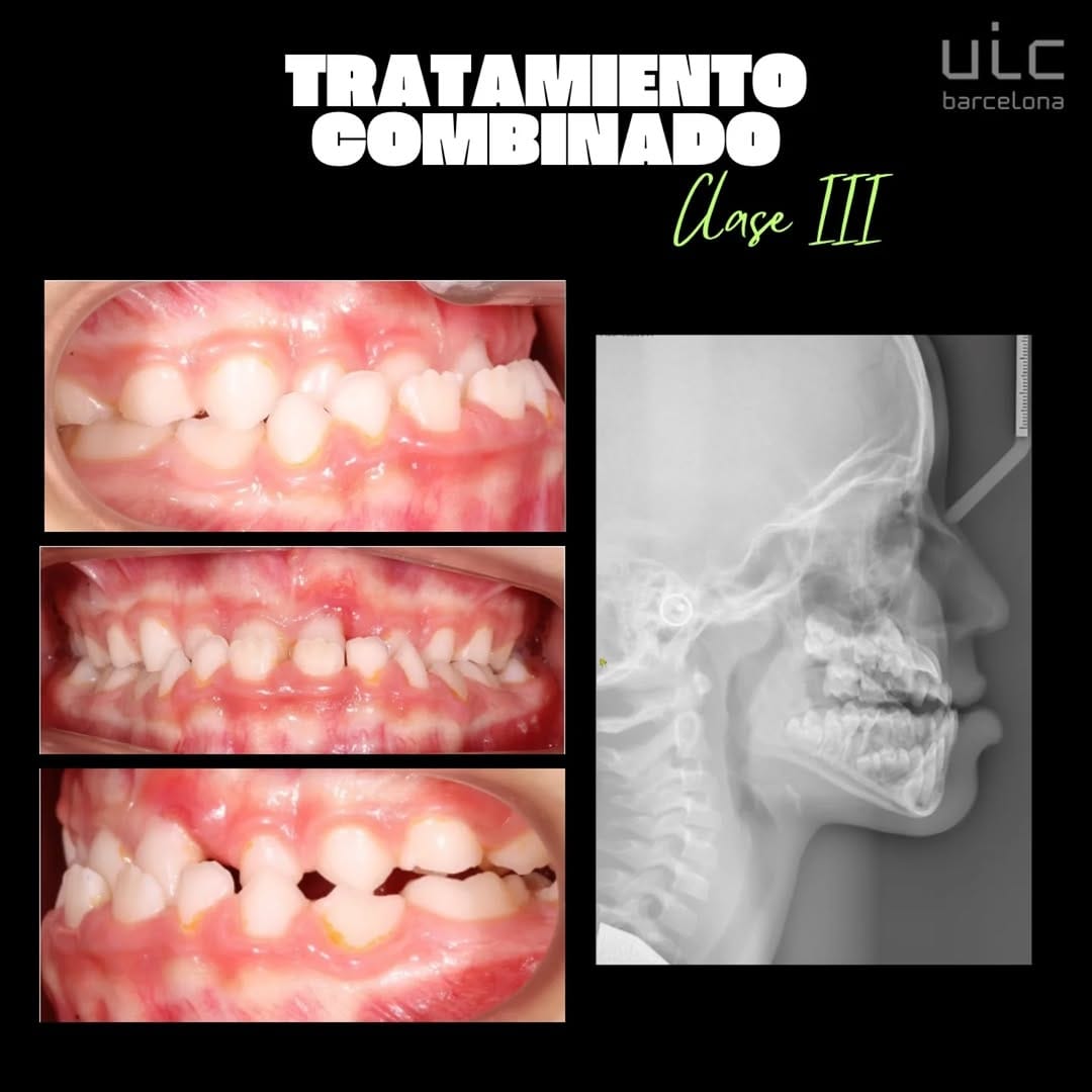 Post 9 by Odontopediatría Uic Barcelona on Instagram (carousel)