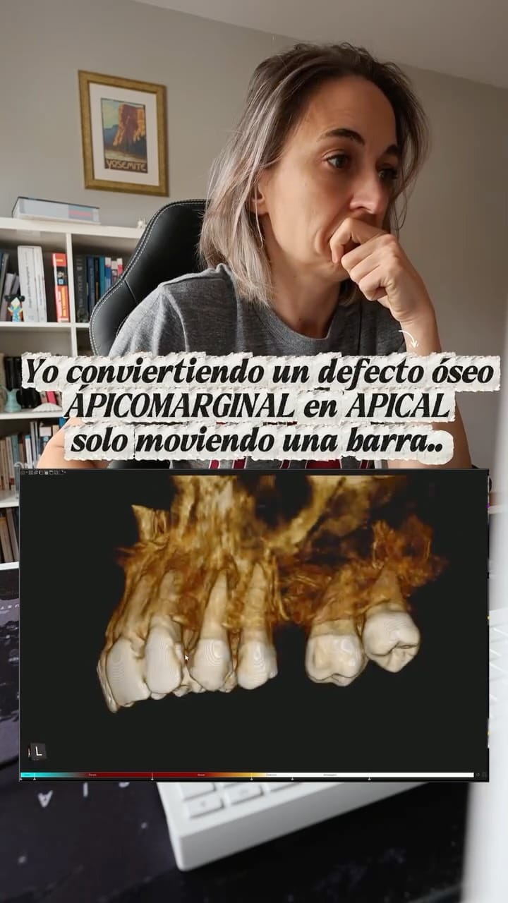 Post 4 by Carolina Martín | CBCT & Endodoncia on Instagram (video)