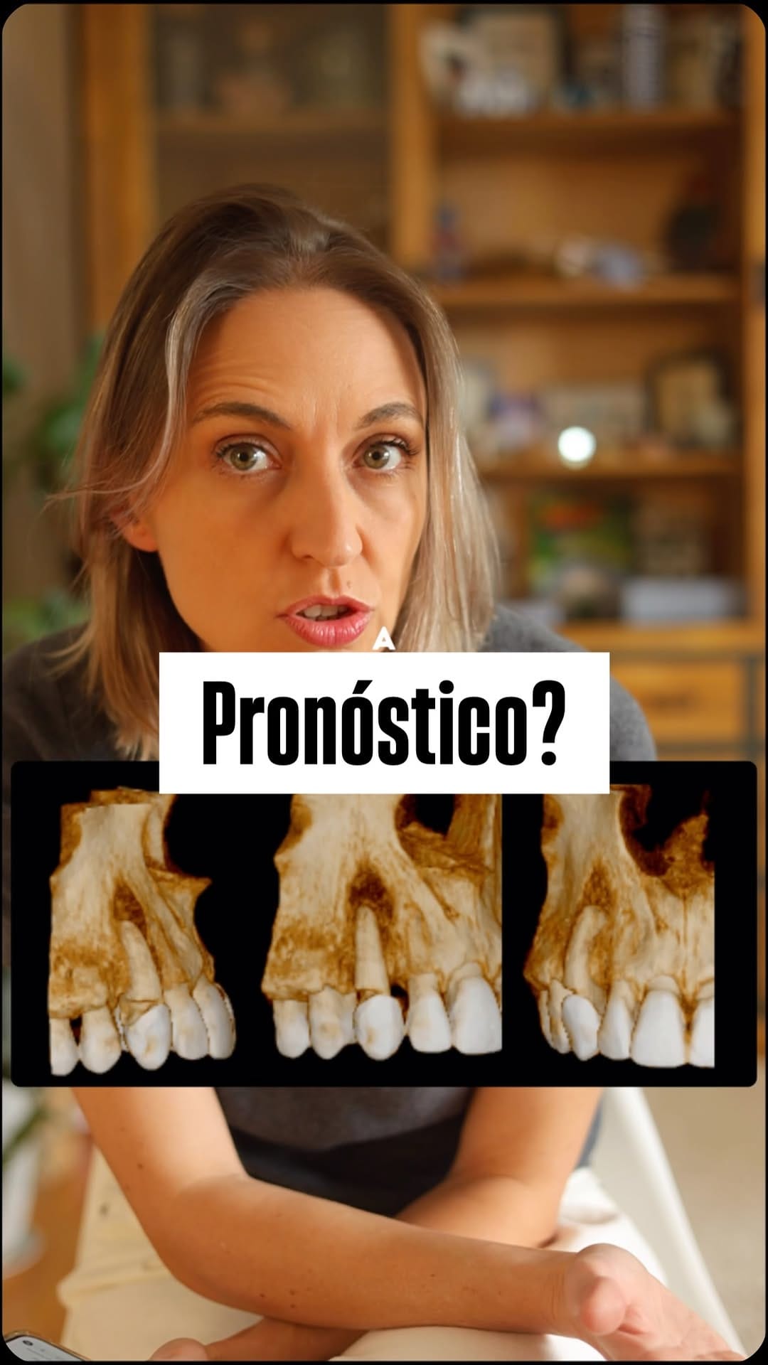 Post 2 by Carolina Martín | CBCT & Endodoncia on Instagram (video)