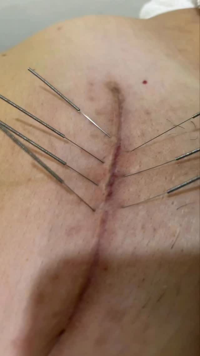Post 4 by Suelo Pélvico Valencia on Instagram (video)