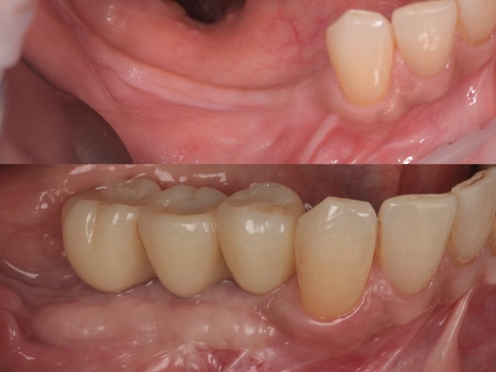 Post 7 by Dr. Erick Mota, DDS, MSD 🇩🇴 on Instagram (image)