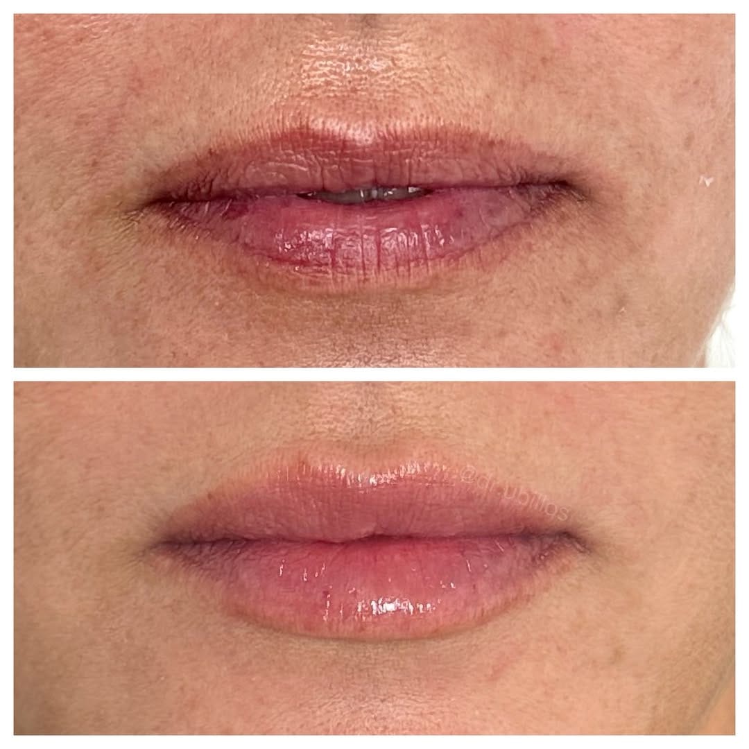 Post 9 by Dra. MJ Ubillos | Medicina Estética Natural on Instagram (image)
