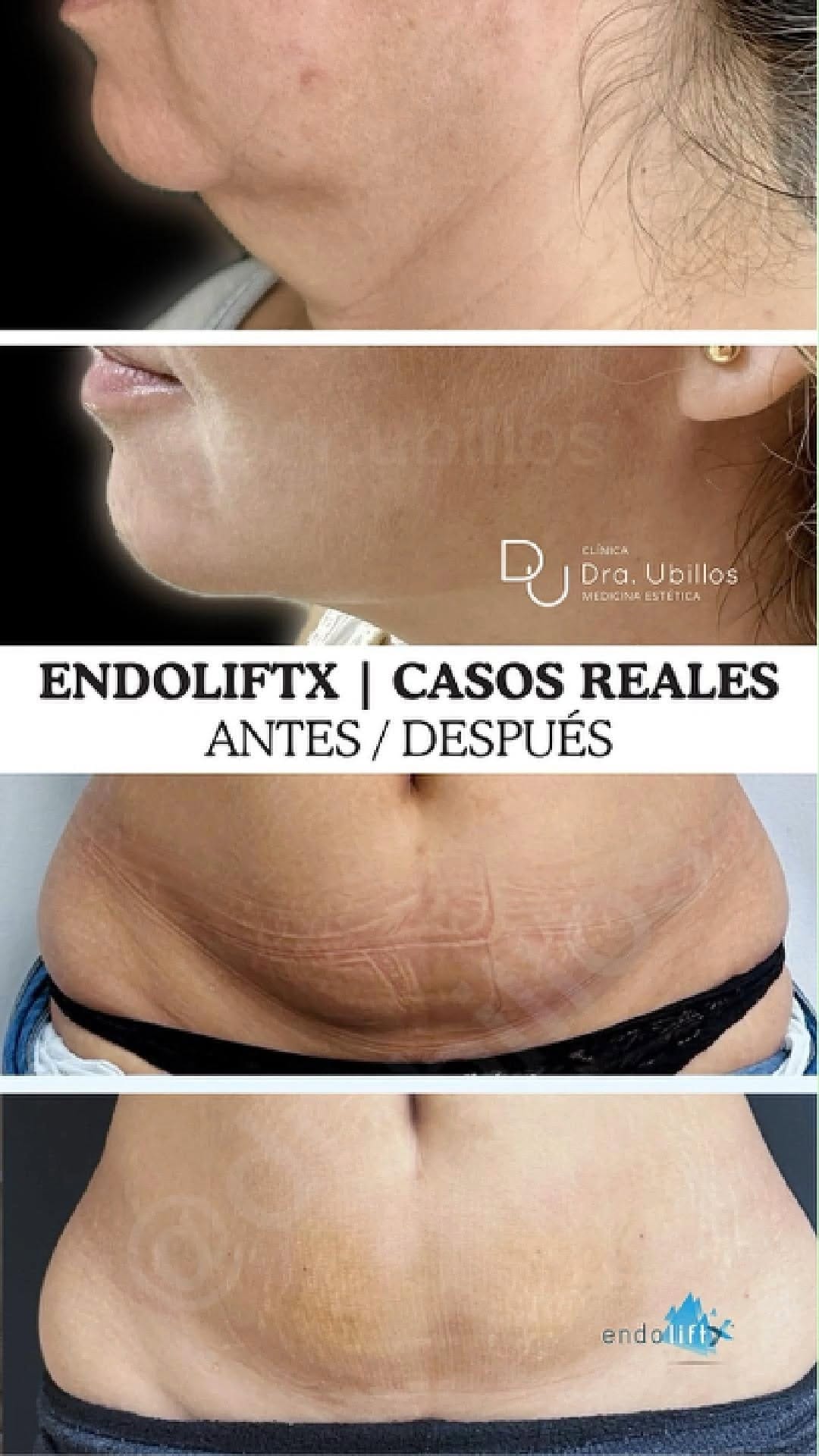 Post 8 by Dra. MJ Ubillos | Medicina Estética Natural on Instagram (video)