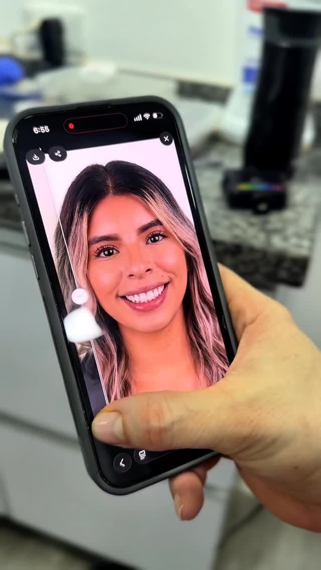 Post 2 by 𝗢𝗱𝗼𝗻𝘁𝗼𝗹𝗼𝗴𝗶𝗮 𝗵𝗶𝗴𝗵 𝗮𝗲𝘀𝘁𝗵𝗲𝘁𝗶𝗰𝘀 on Instagram (video)