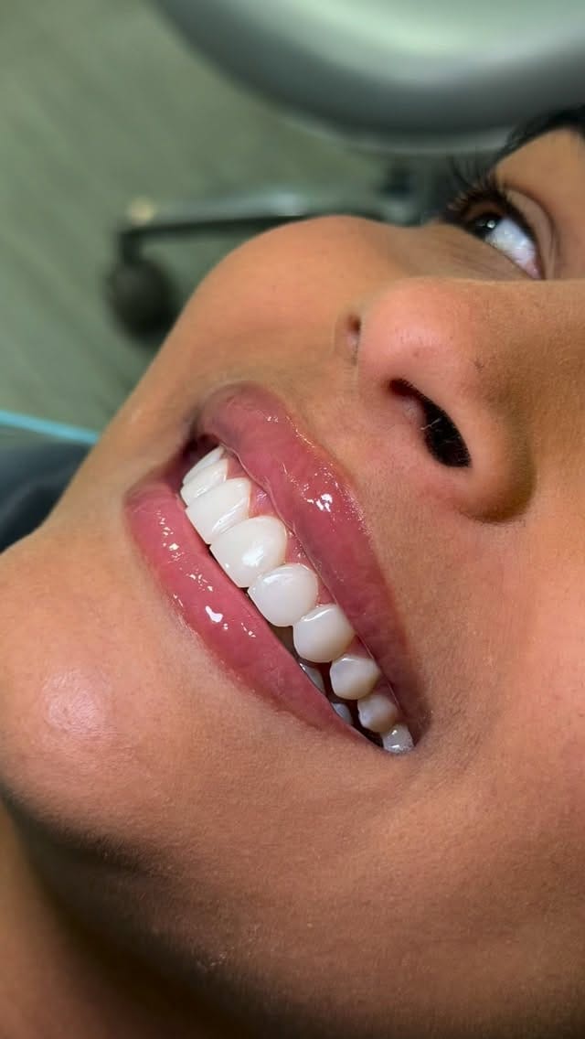 Post 4 by 𝗢𝗱𝗼𝗻𝘁𝗼𝗹𝗼𝗴𝗶𝗮 𝗵𝗶𝗴𝗵 𝗮𝗲𝘀𝘁𝗵𝗲𝘁𝗶𝗰𝘀 on Instagram (video)