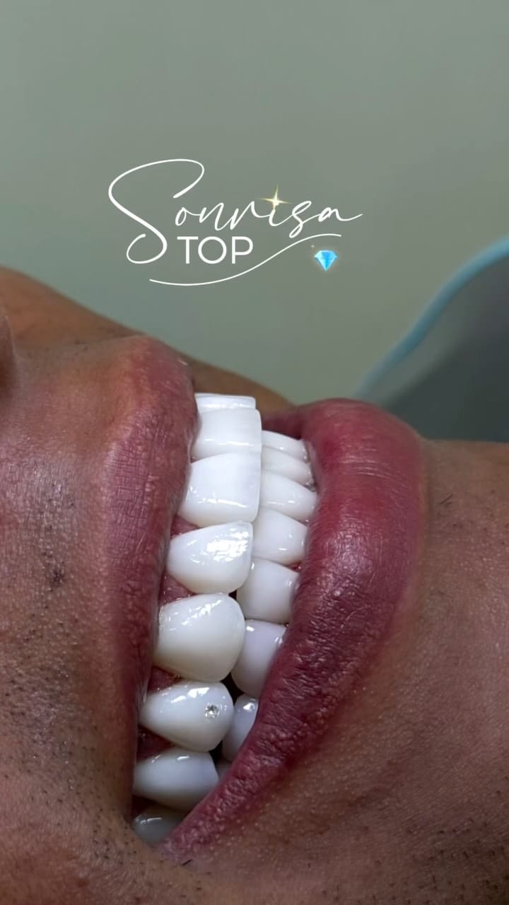 Post 6 by 𝗢𝗱𝗼𝗻𝘁𝗼𝗹𝗼𝗴𝗶𝗮 𝗵𝗶𝗴𝗵 𝗮𝗲𝘀𝘁𝗵𝗲𝘁𝗶𝗰𝘀 on Instagram (video)