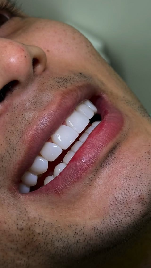 Post 3 by 𝗢𝗱𝗼𝗻𝘁𝗼𝗹𝗼𝗴𝗶𝗮 𝗵𝗶𝗴𝗵 𝗮𝗲𝘀𝘁𝗵𝗲𝘁𝗶𝗰𝘀 on Instagram (video)