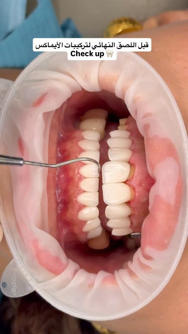 Post 8 by Dr. 𝐅𝐨𝐮𝐚𝐝 𝐀𝐥_𝐦𝐚𝐬𝐡𝐡𝐝𝐚𝐧𝐲 ⭕️ الدكتور فؤاد المشهداني on Instagram (video)