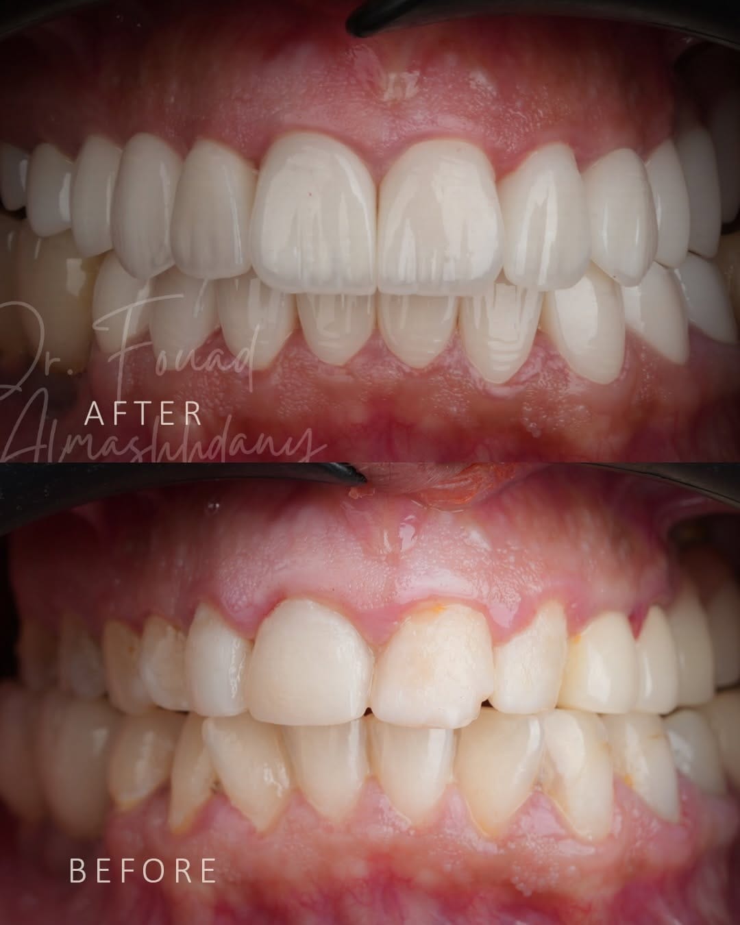 Post 6 by Dr. 𝐅𝐨𝐮𝐚𝐝 𝐀𝐥_𝐦𝐚𝐬𝐡𝐡𝐝𝐚𝐧𝐲 ⭕️ الدكتور فؤاد المشهداني on Instagram (carousel)