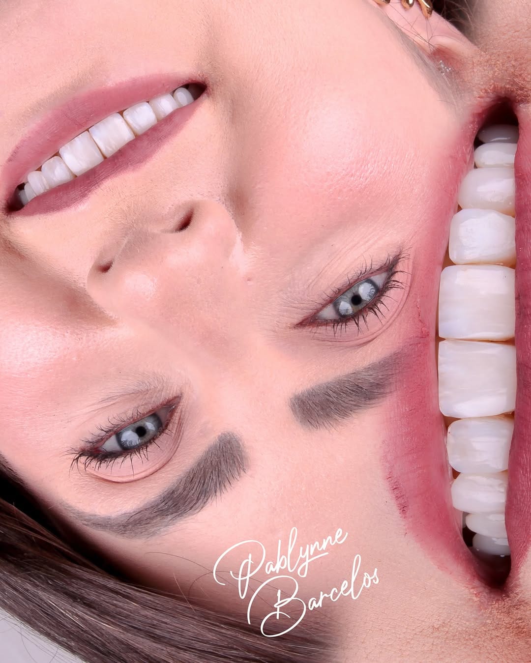 Post 1 by Dra Pablynne Barcelos | Lentes em Resina Palmas TO on Instagram (image)