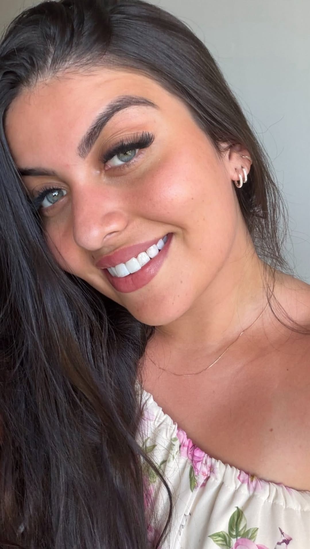 Post 6 by Dra Pablynne Barcelos | Lentes em Resina Palmas TO on Instagram (video)