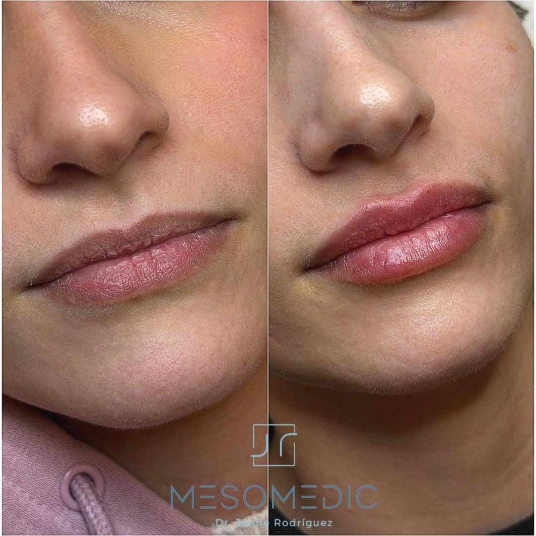 Post 4 by Medicina Estética Mallorca on Instagram (carousel)