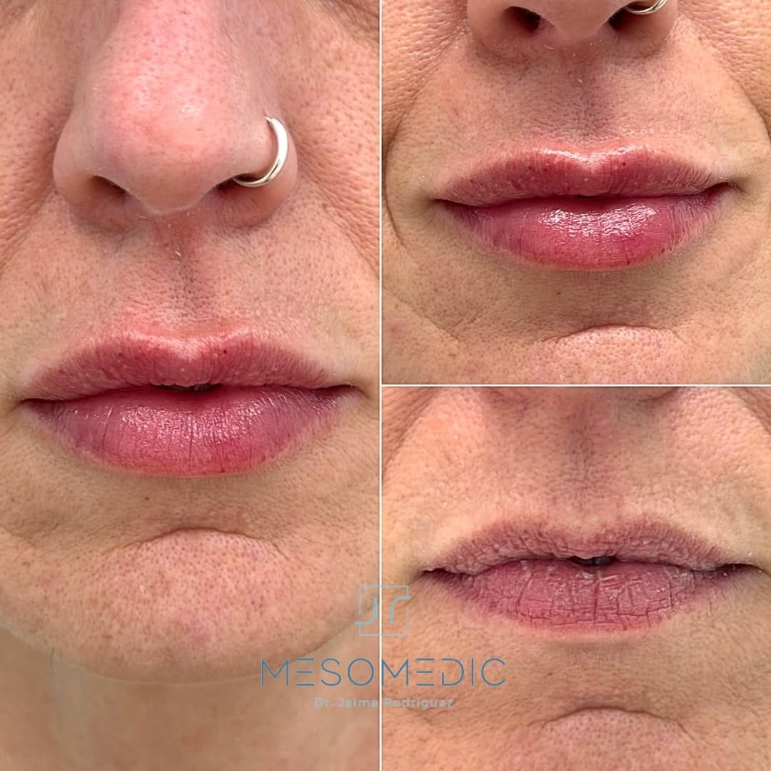 Post 7 by Medicina Estética Mallorca on Instagram (image)