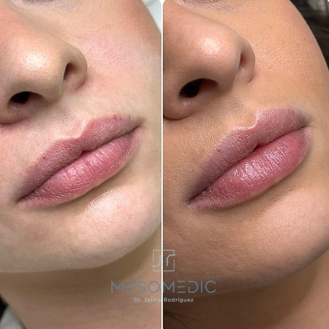 Post 9 by Medicina Estética Mallorca on Instagram (image)