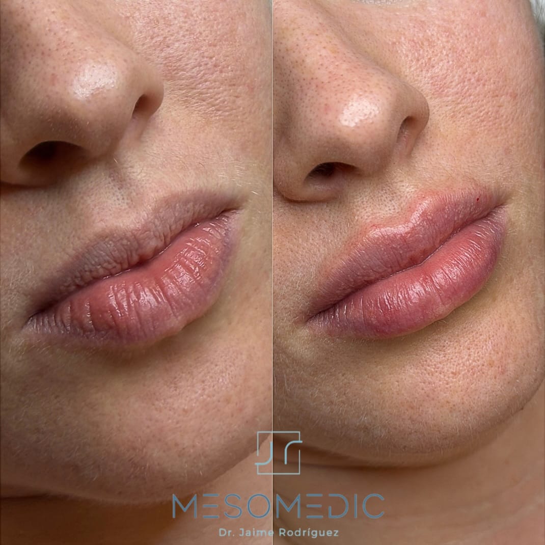 Post 1 by Medicina Estética Mallorca on Instagram (image)