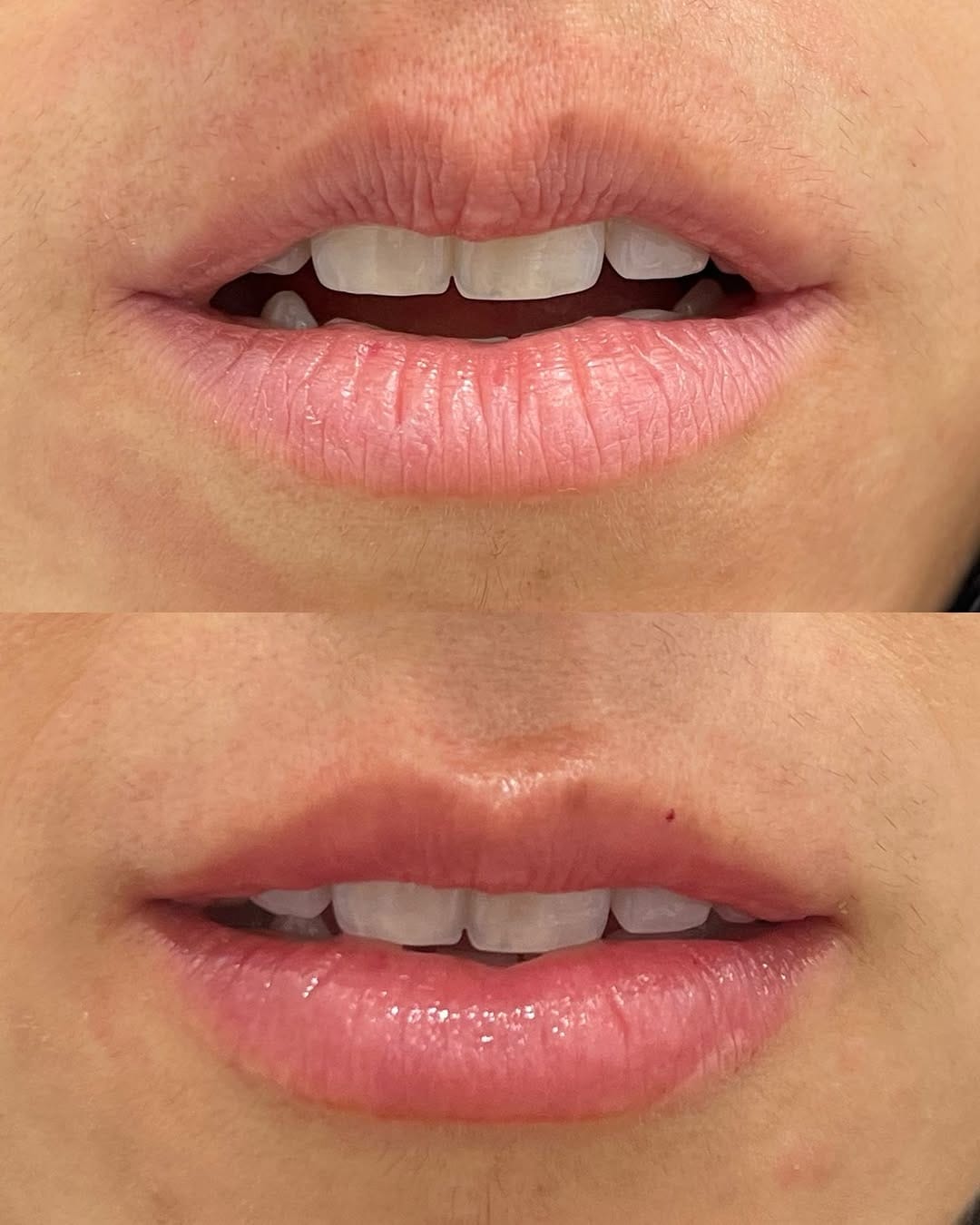 Post 4 by Dra. Lucía González Ruiz - Dermatóloga - Clínica LG DERMA on Instagram (image)
