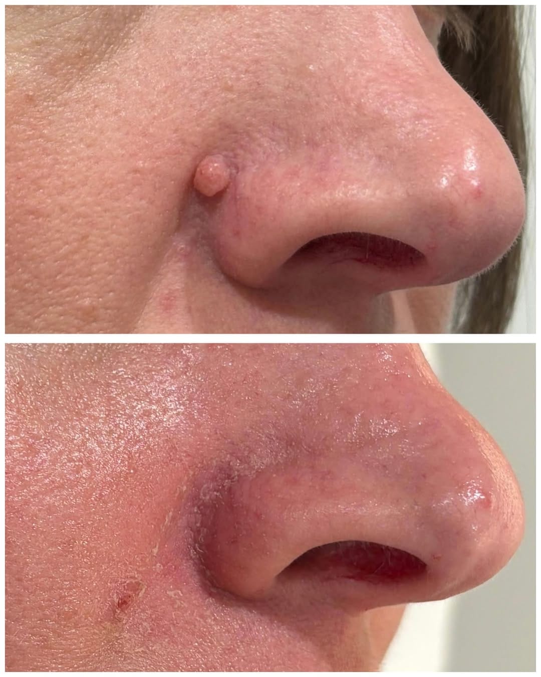 Post 1 by Dra. Lucía González Ruiz - Dermatóloga - Clínica LG DERMA on Instagram (image)