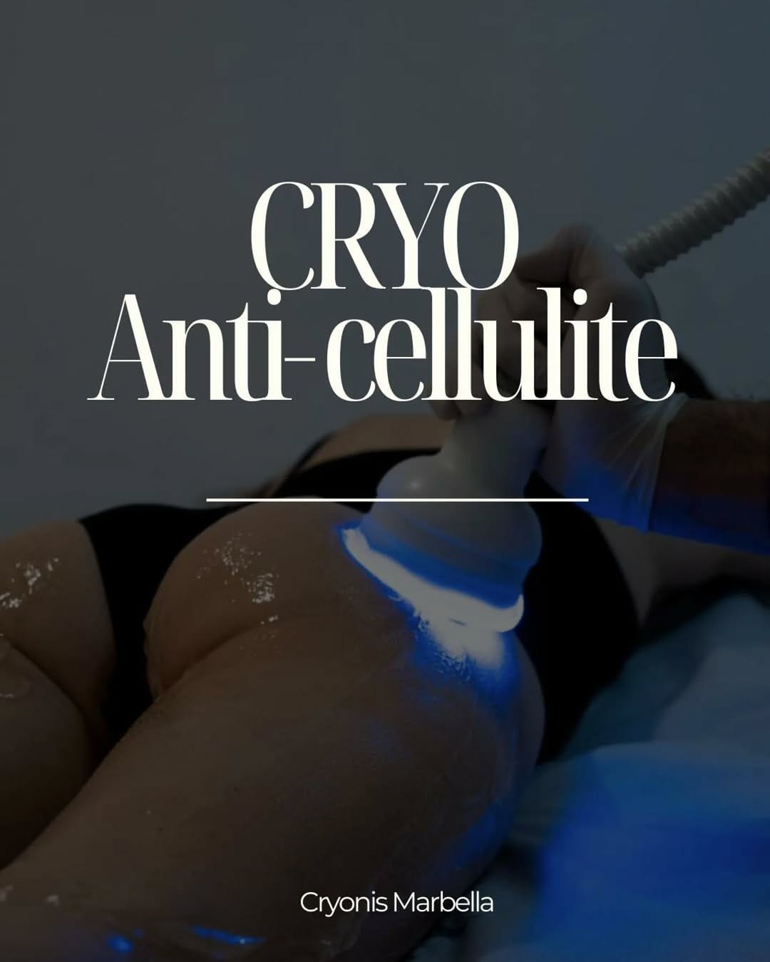 Post 3 by CRYOTHERAPY ❄️ on Instagram (carousel)