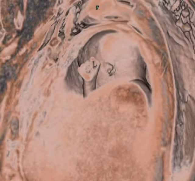 Post 7 by Dr. Miguel A. Barber on Instagram (video)