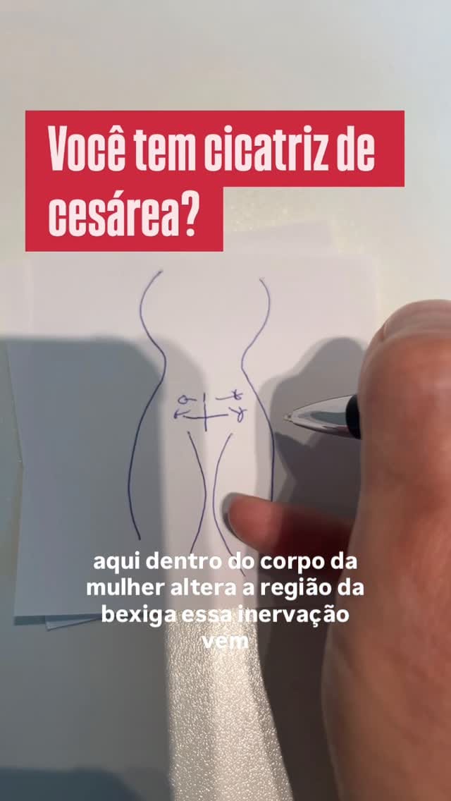 Post 8 by Dr. Emmanuel Duque 👁❤️Terapia Neural e Oftalmologia - São Paulo on Instagram (video)