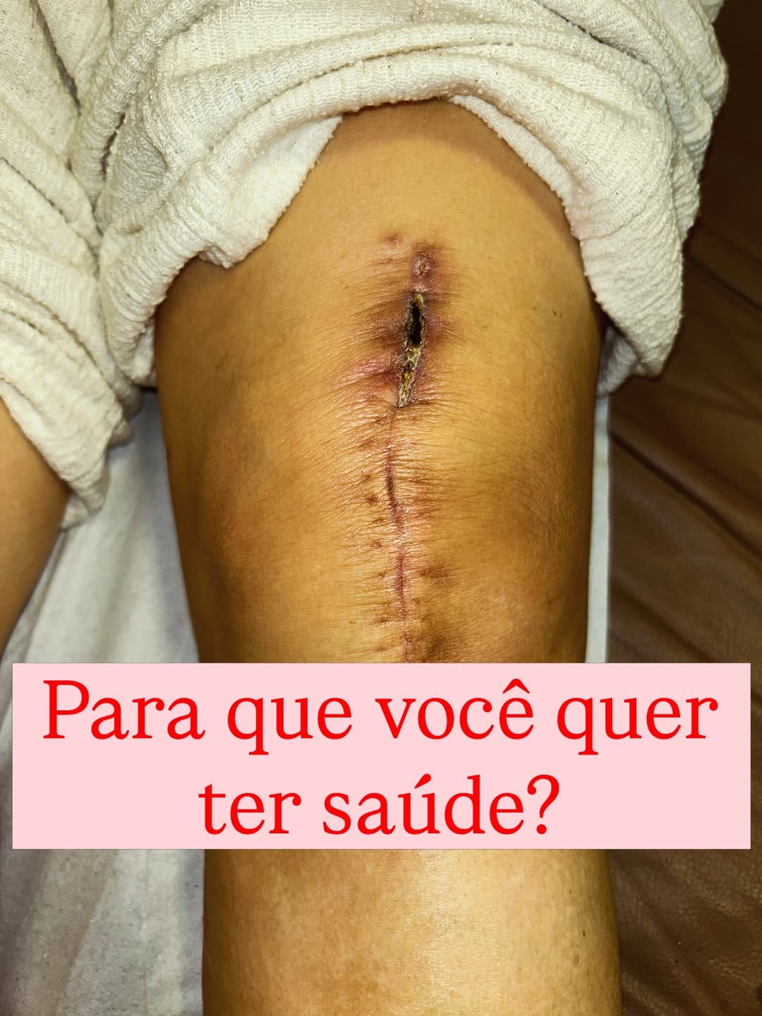 Post 1 by Dr. Emmanuel Duque 👁❤️Terapia Neural e Oftalmologia - São Paulo on Instagram (carousel)