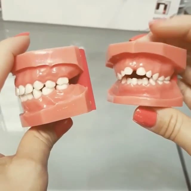 Post 10 by Adriana Pop - Logopeda on Instagram (video)
