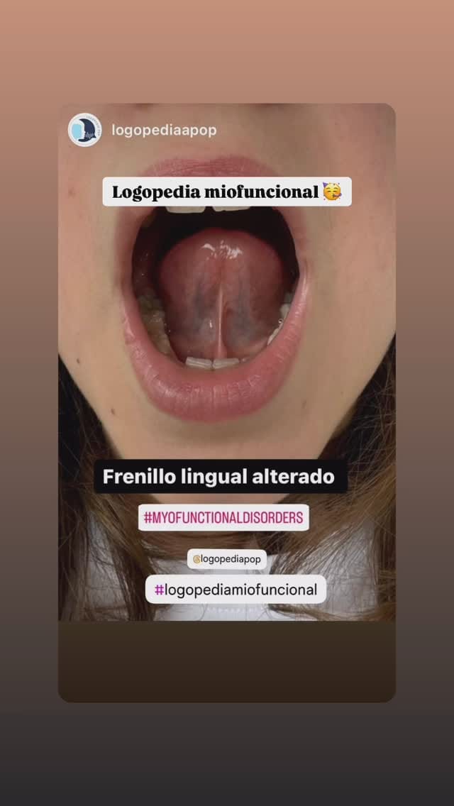 Post 6 by Adriana Pop - Logopeda on Instagram (video)
