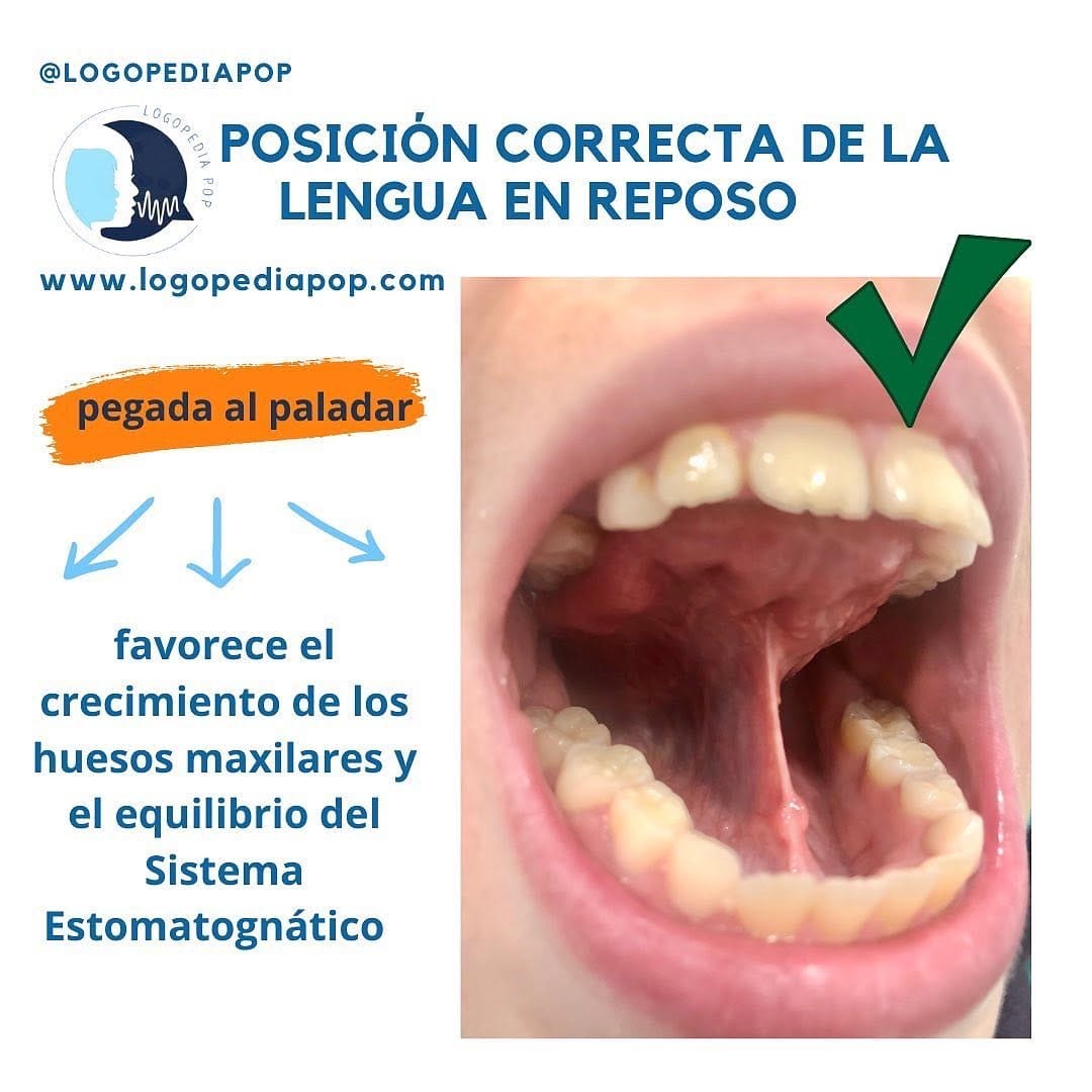 Post 8 by Adriana Pop - Logopeda on Instagram (image)