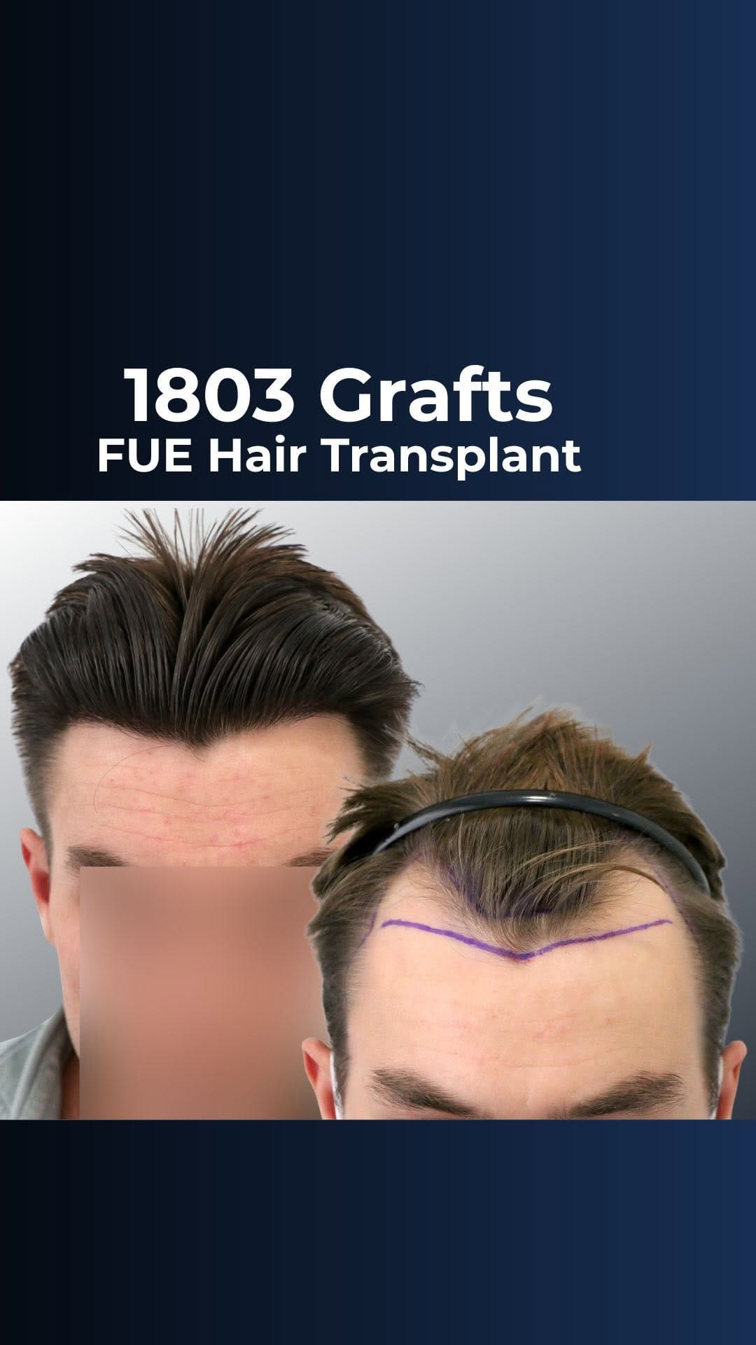 Post 1 by FUExpert Clinic on Instagram (video)