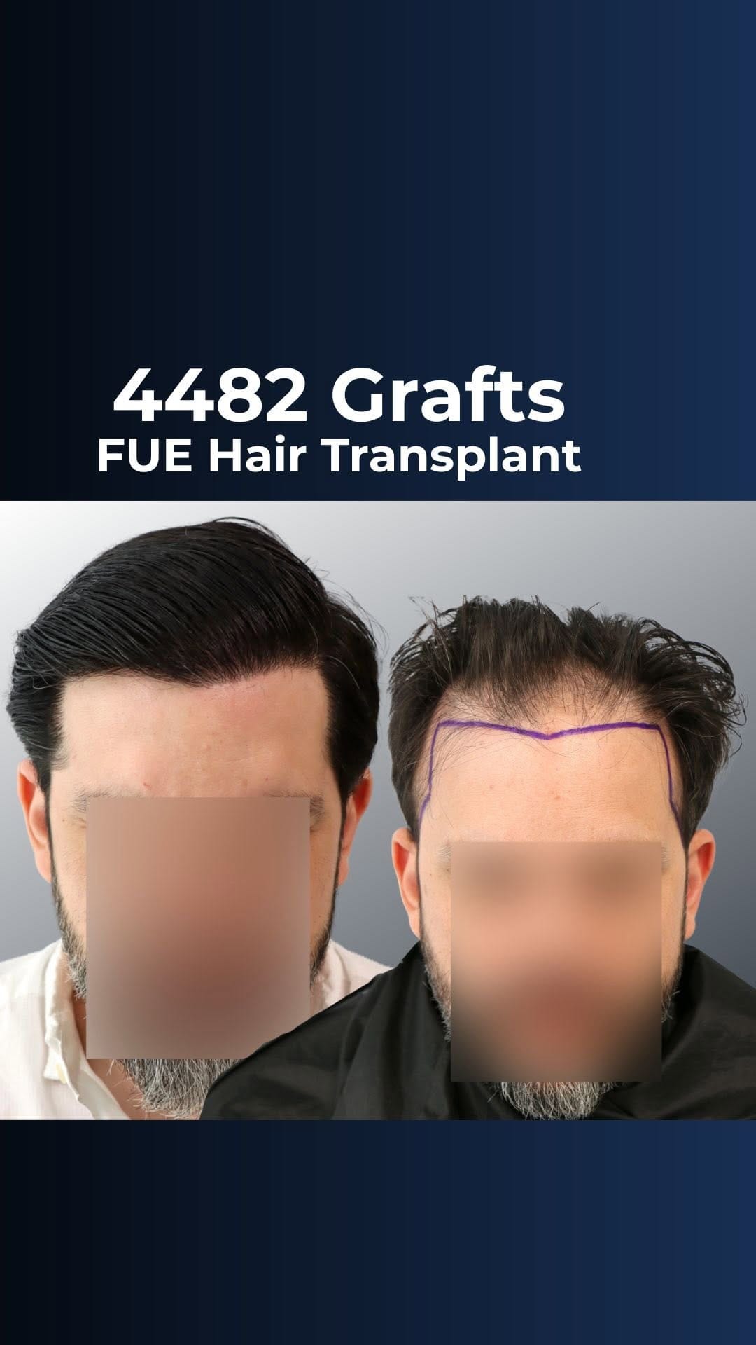 Post 3 by FUExpert Clinic on Instagram (video)