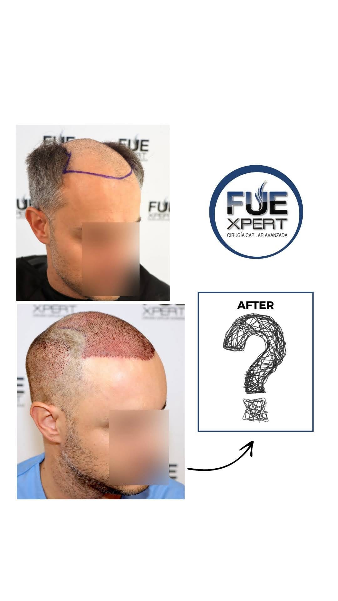 Post 6 by FUExpert Clinic on Instagram (video)
